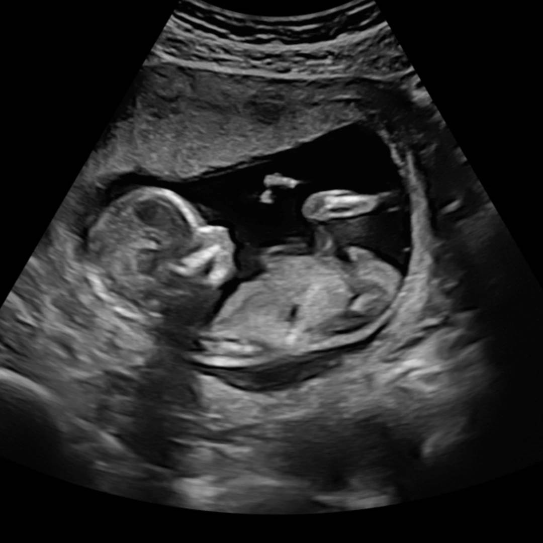 Photo shared by Daphne for their Babylist baby registry.