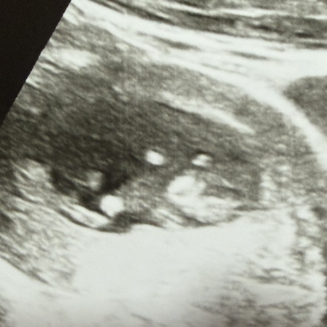 Photo shared by Leilany for their Babylist baby registry.