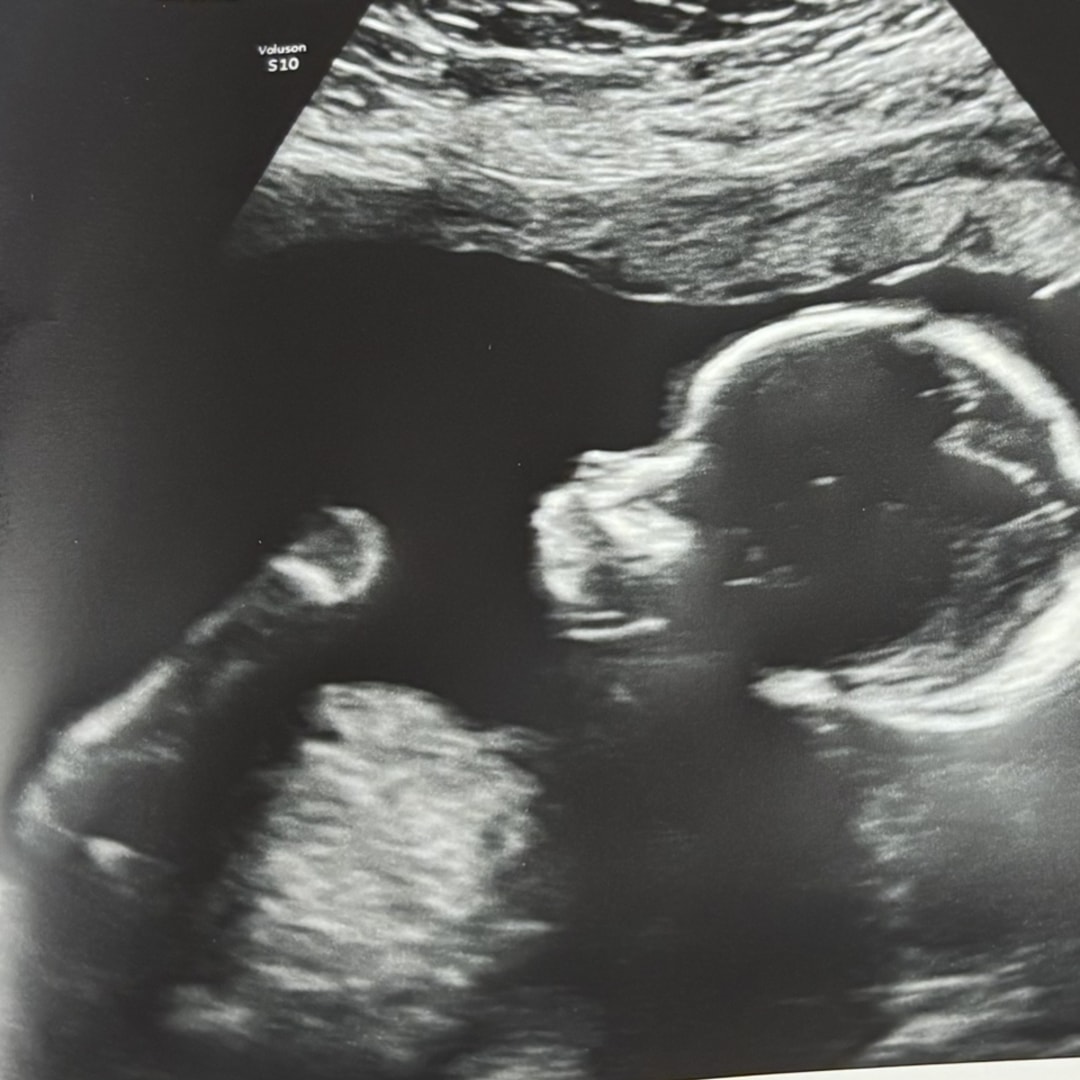 Photo shared by Nakia for their Babylist baby registry.