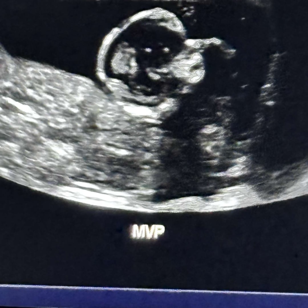 Photo shared by Bailey for their Babylist baby registry.