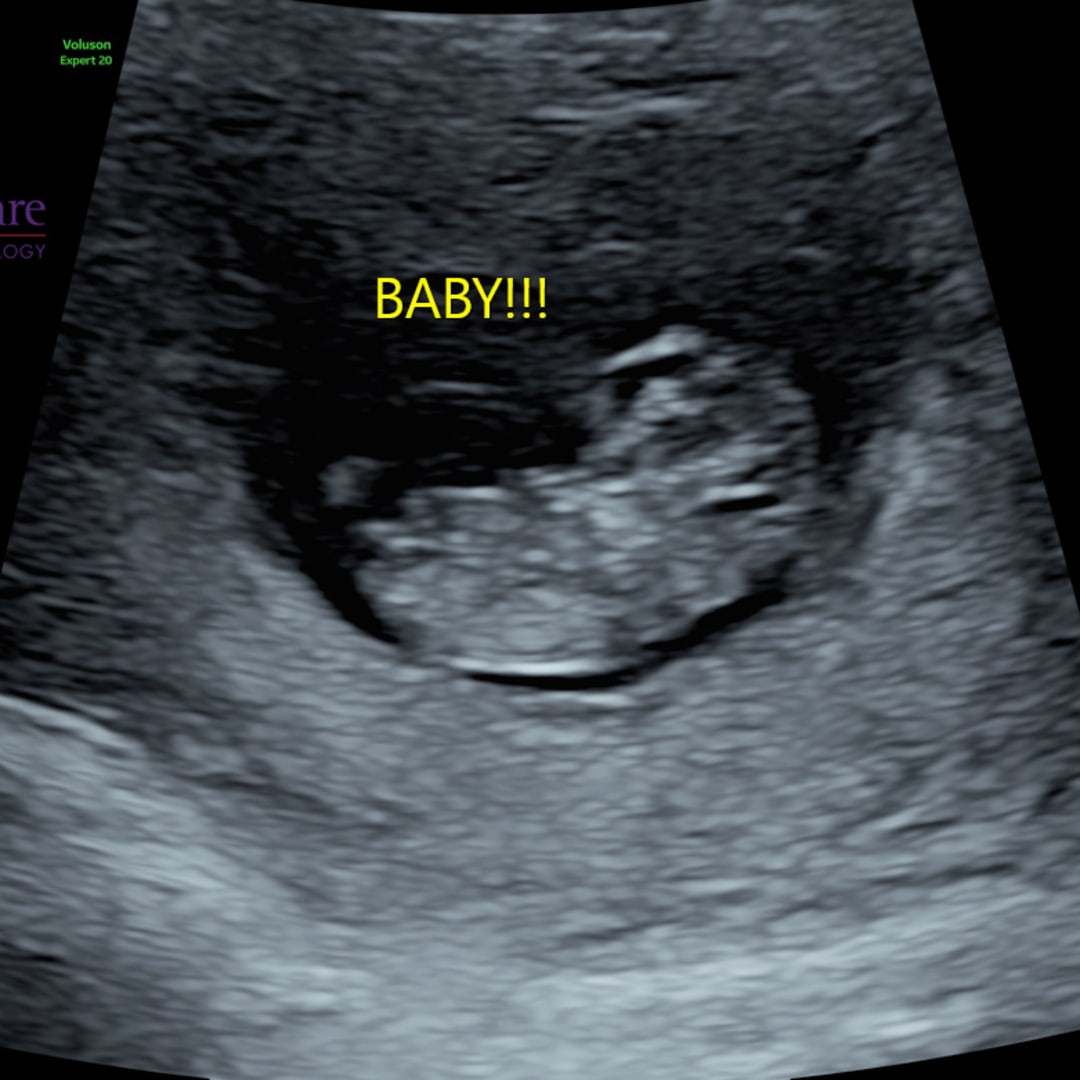 Photo shared by Devon for their Babylist baby registry.