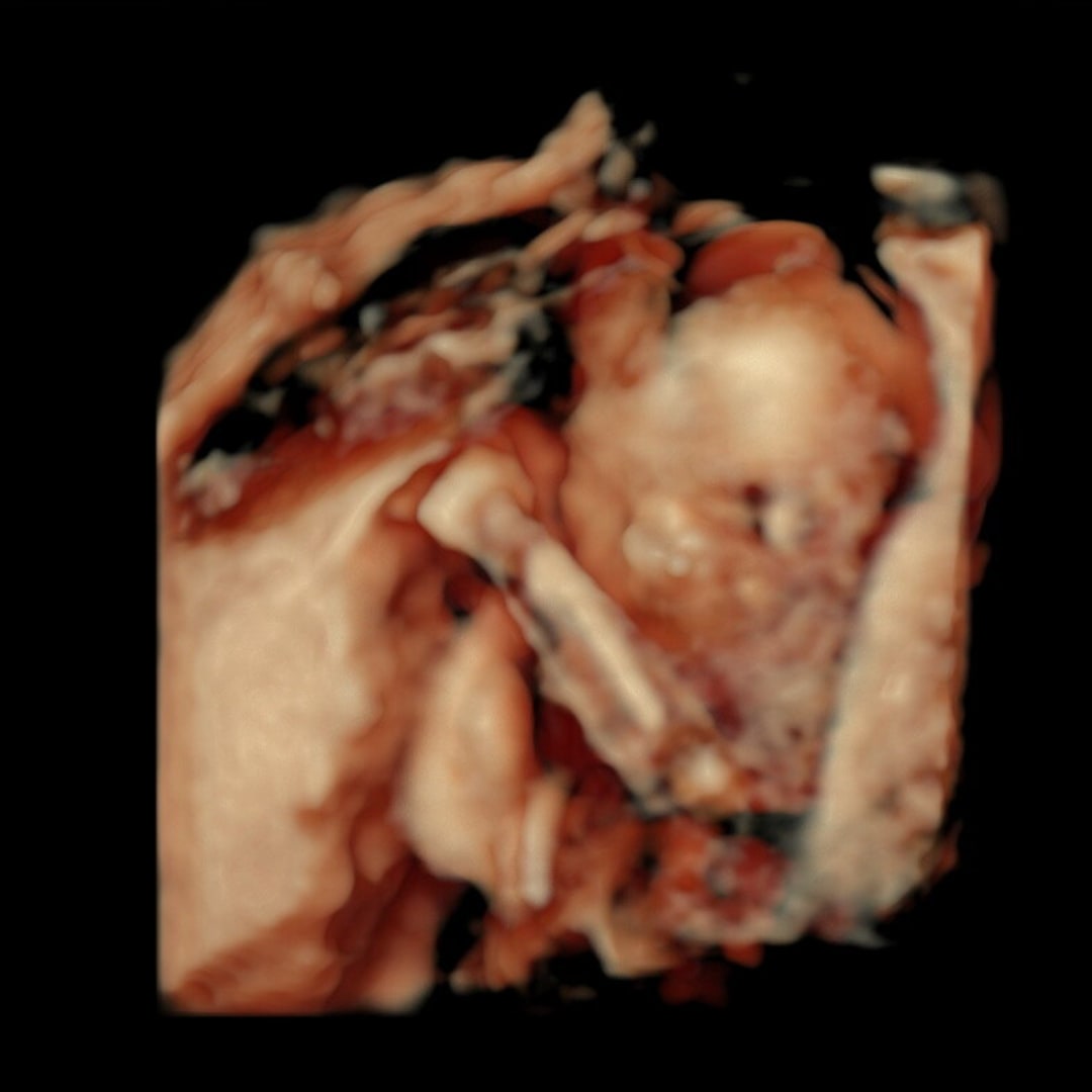 Photo shared by Esperanza for their Babylist baby registry.