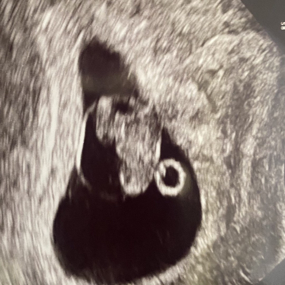 Photo shared by Erin for their Babylist baby registry.