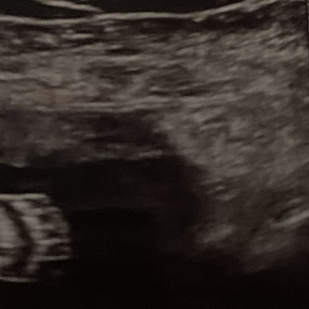 Photo shared by Feliciano for their Babylist baby registry.