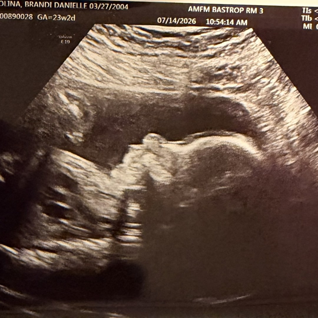 Photo shared by Brandi for their Babylist baby registry.