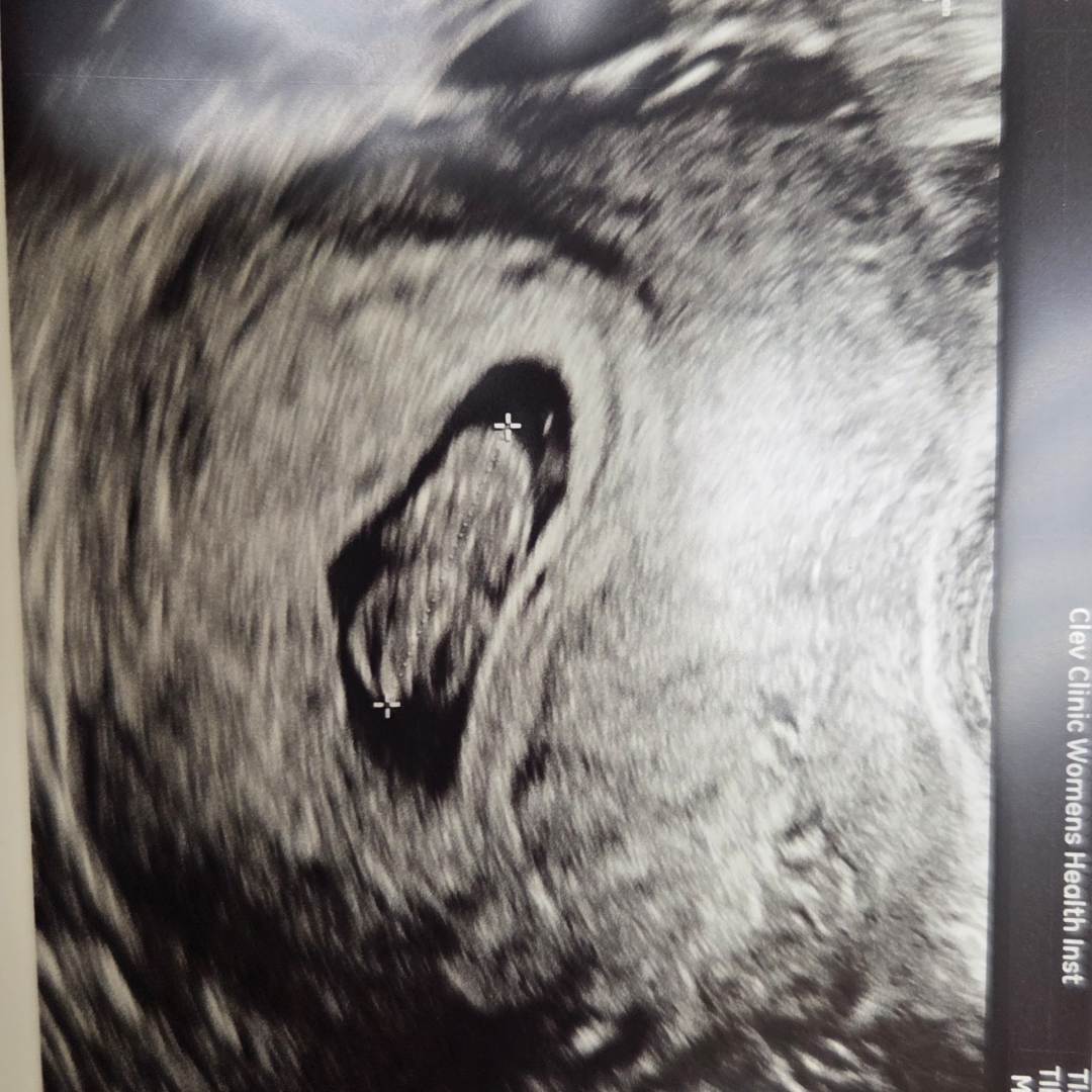 Photo shared by Elaine for their Babylist baby registry.