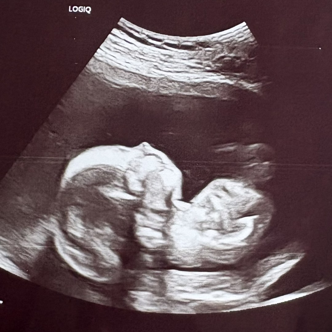 Photo shared by Camryn for their Babylist baby registry.