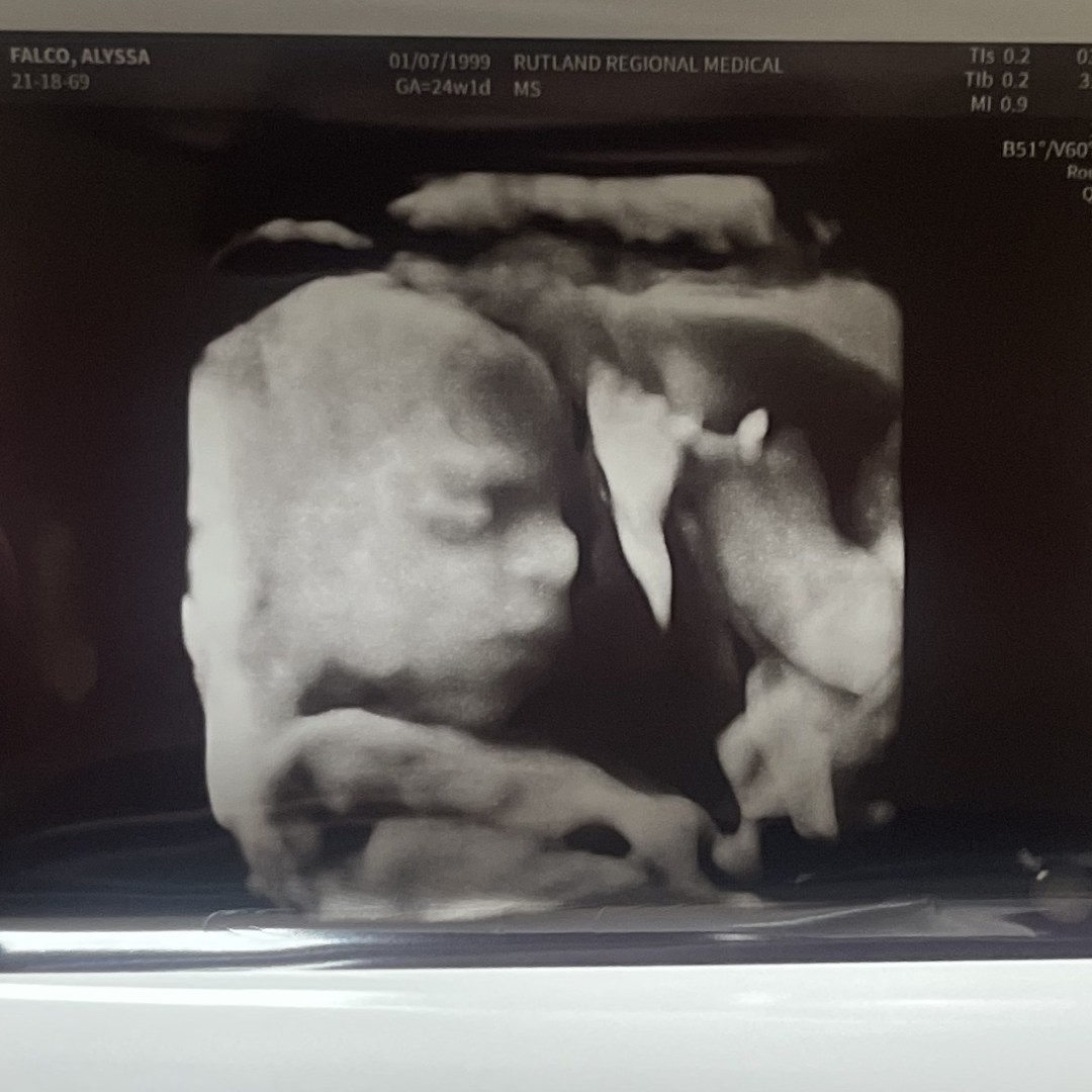 Photo shared by Alyssa for their Babylist baby registry.