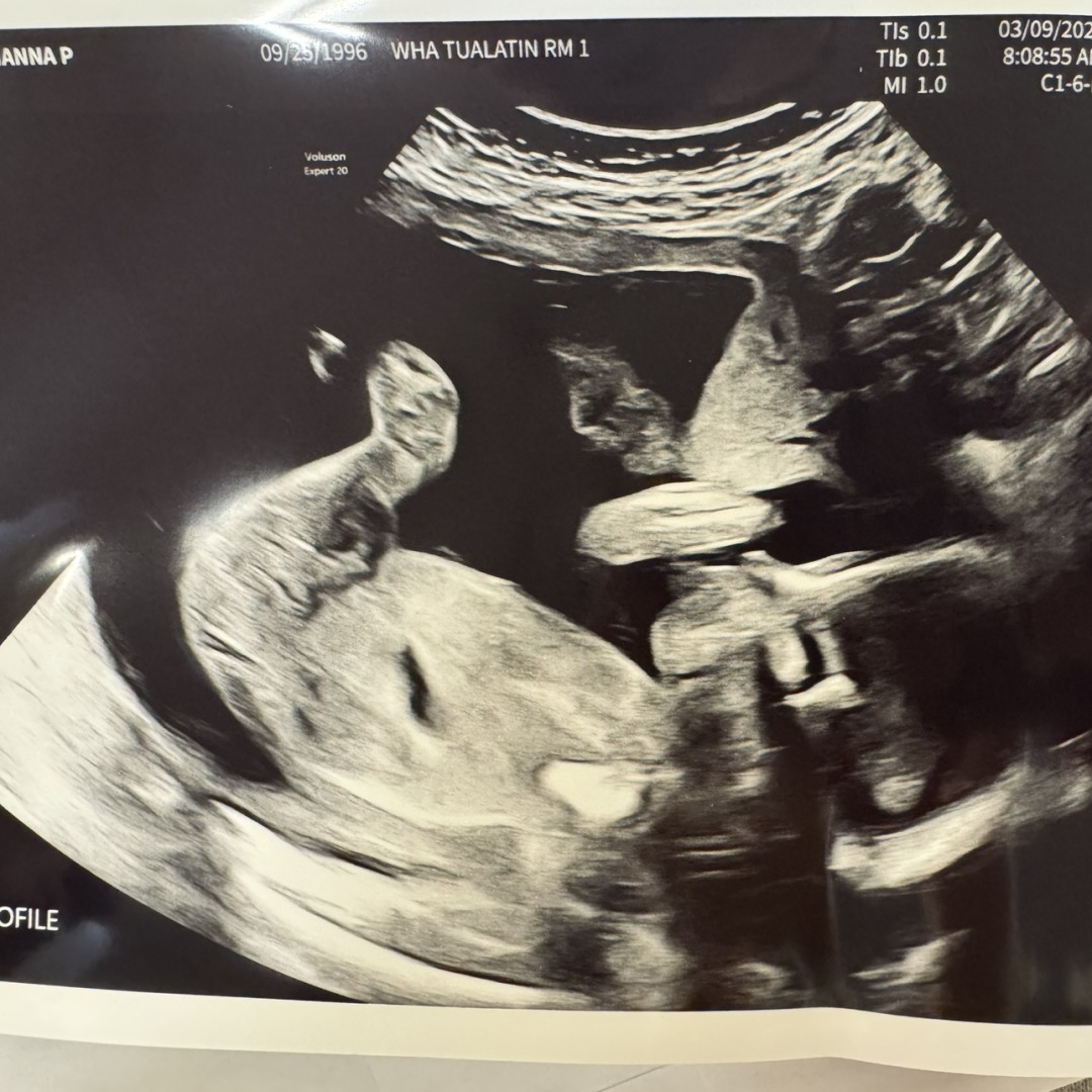 Photo shared by Hanna for their Babylist baby registry.