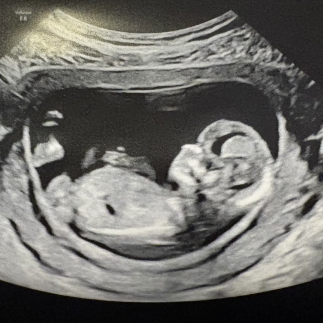 Photo shared by Taylor for their Babylist baby registry.