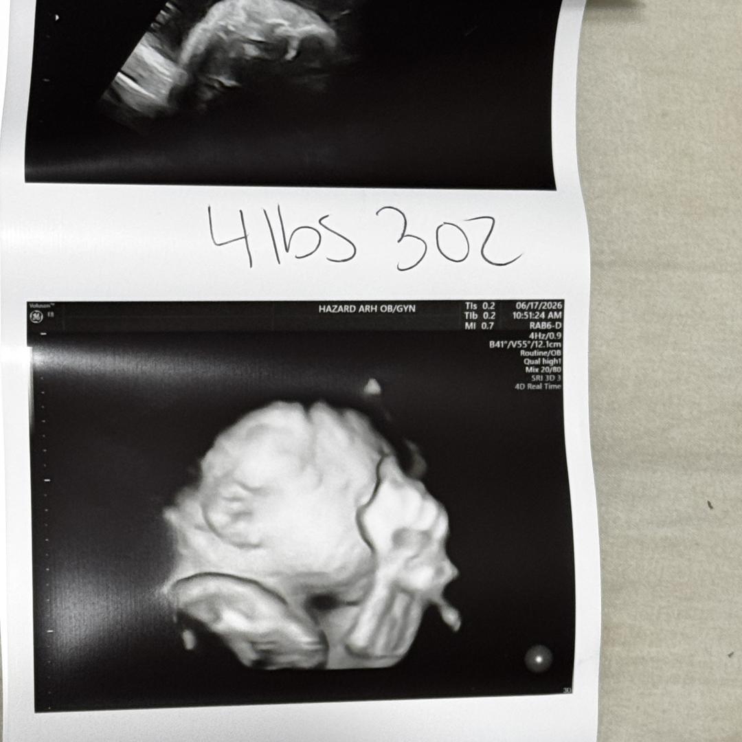 Photo shared by Amber for their Babylist baby registry.