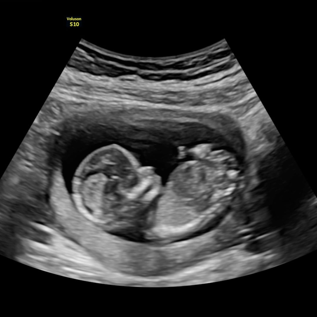 Photo shared by Ynfiniti for their Babylist baby registry.