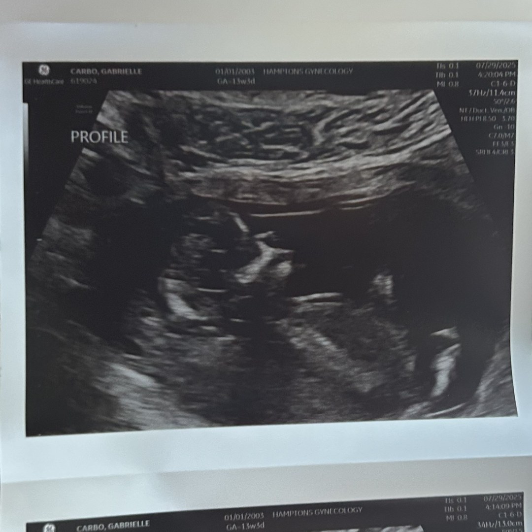Photo shared by Gabrielle for their Babylist baby registry.
