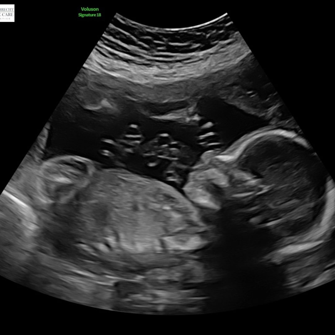 Photo shared by Cassidy for their Babylist baby registry.