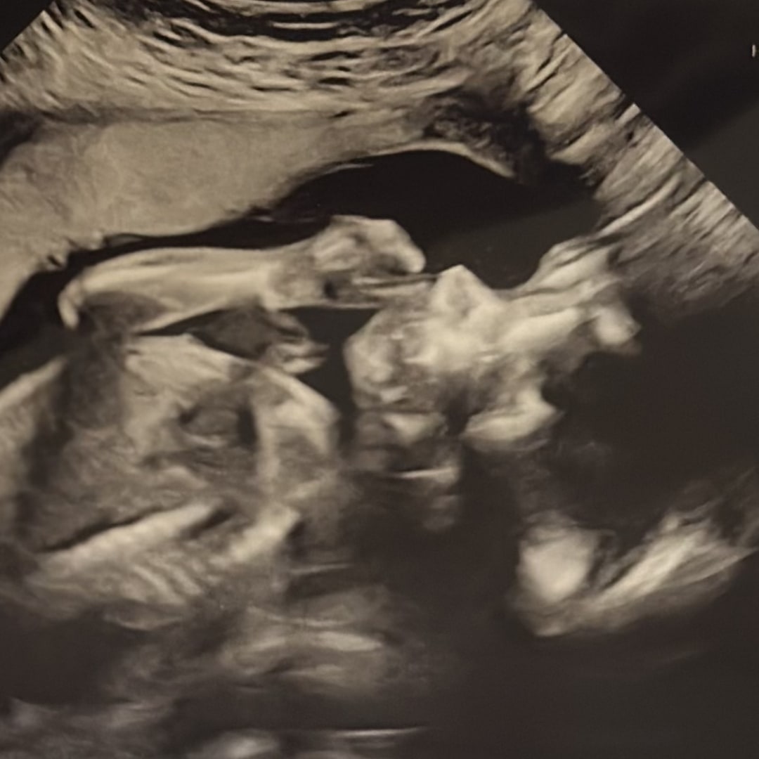 Photo shared by Taylor for their Babylist baby registry.