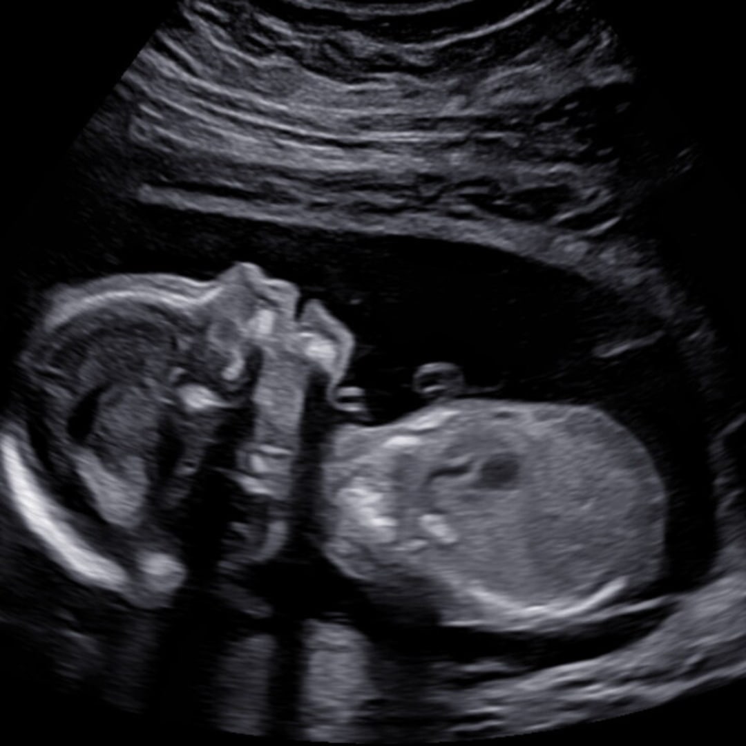 Photo shared by Kendra for their Babylist baby registry.