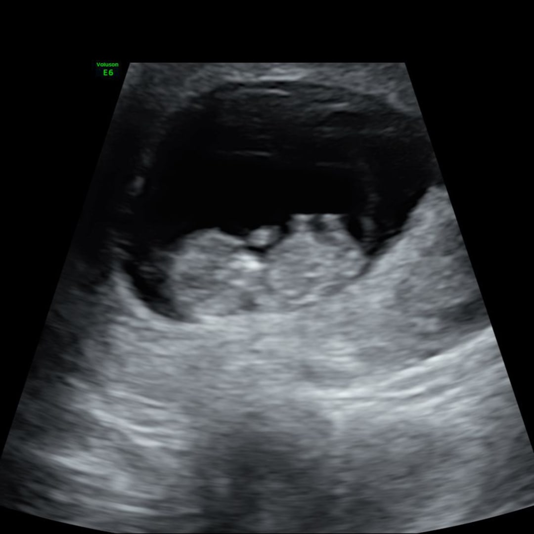 Photo shared by Melissa for their Babylist baby registry.