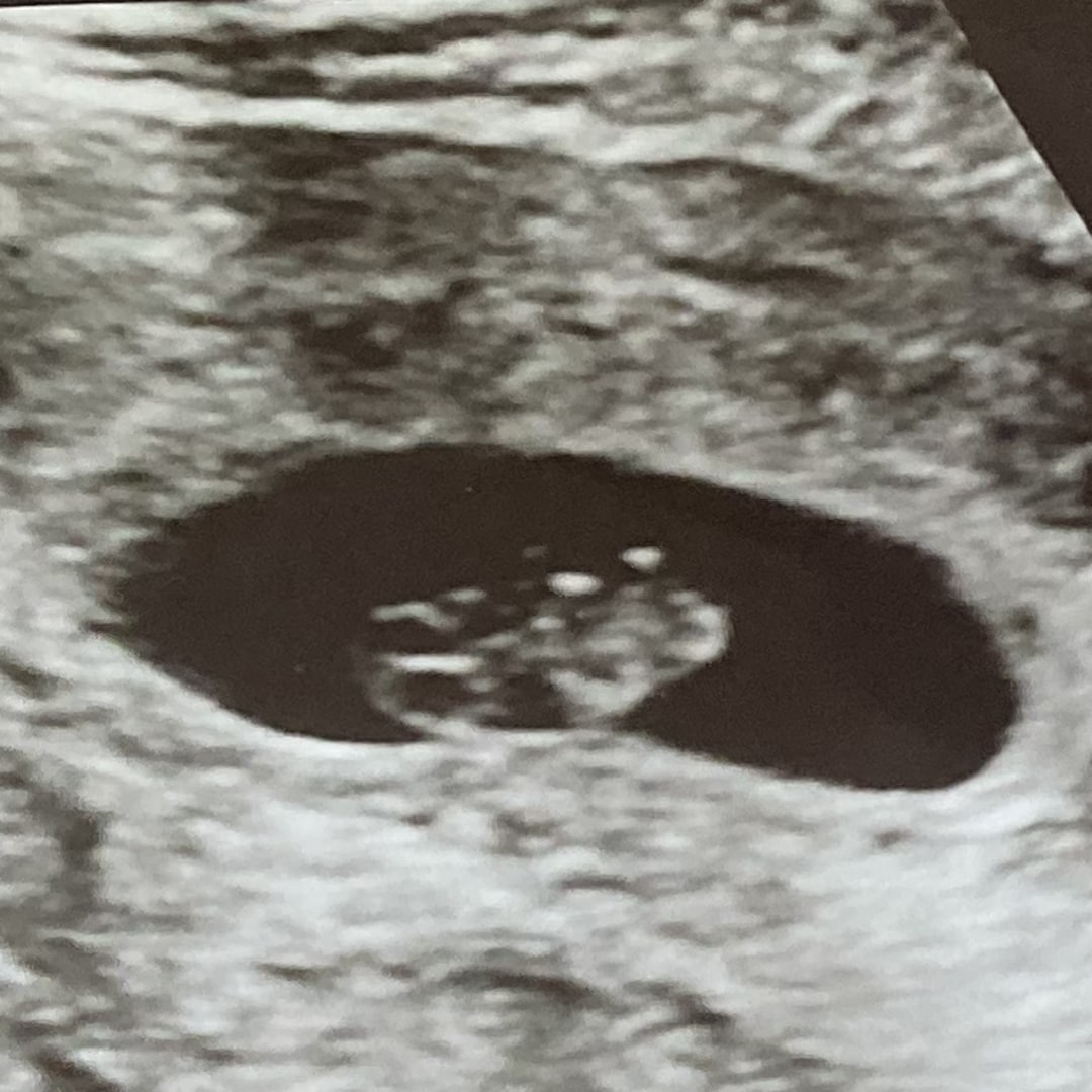 Photo shared by Aleeyah for their Babylist baby registry.