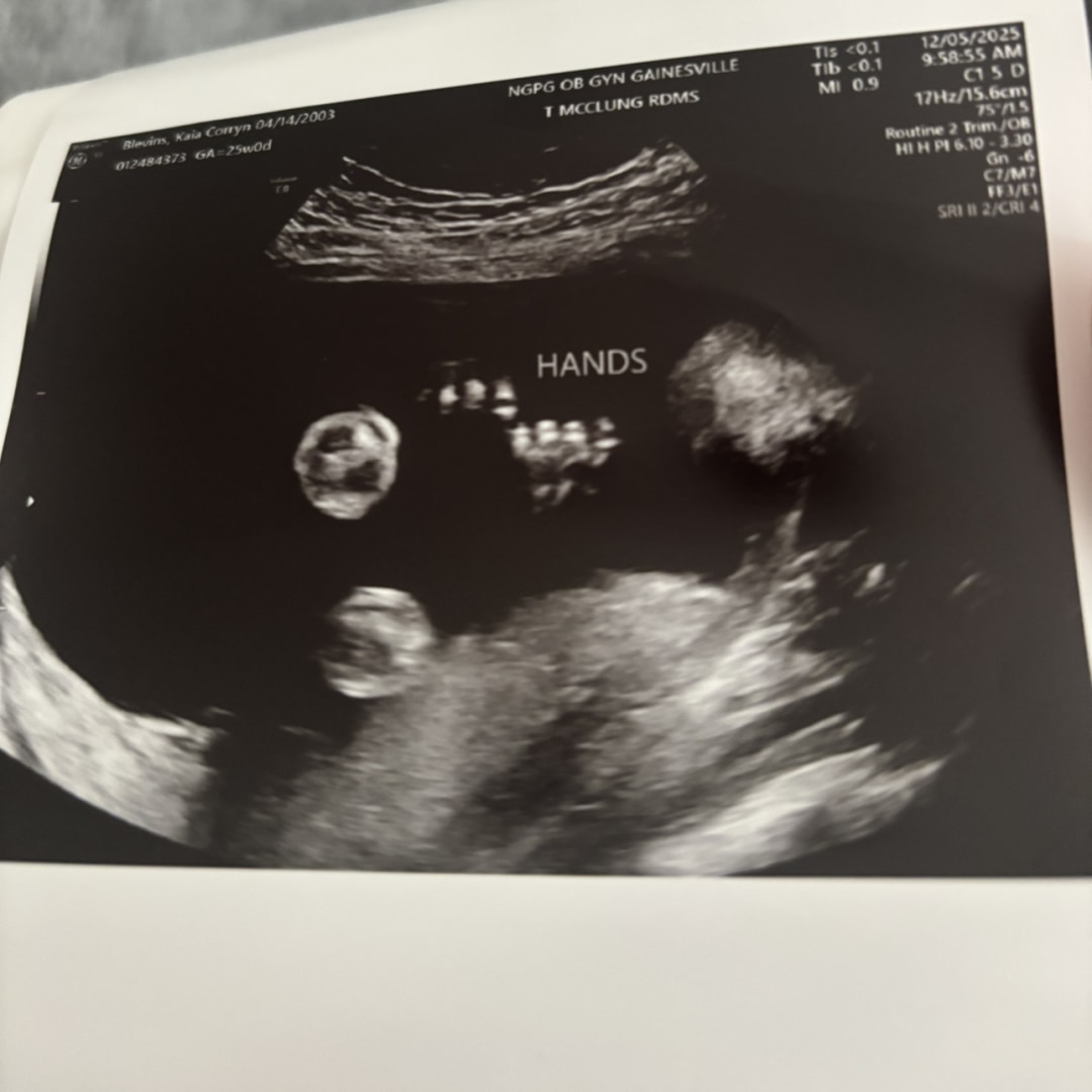 Photo shared by Kaia for their Babylist baby registry.