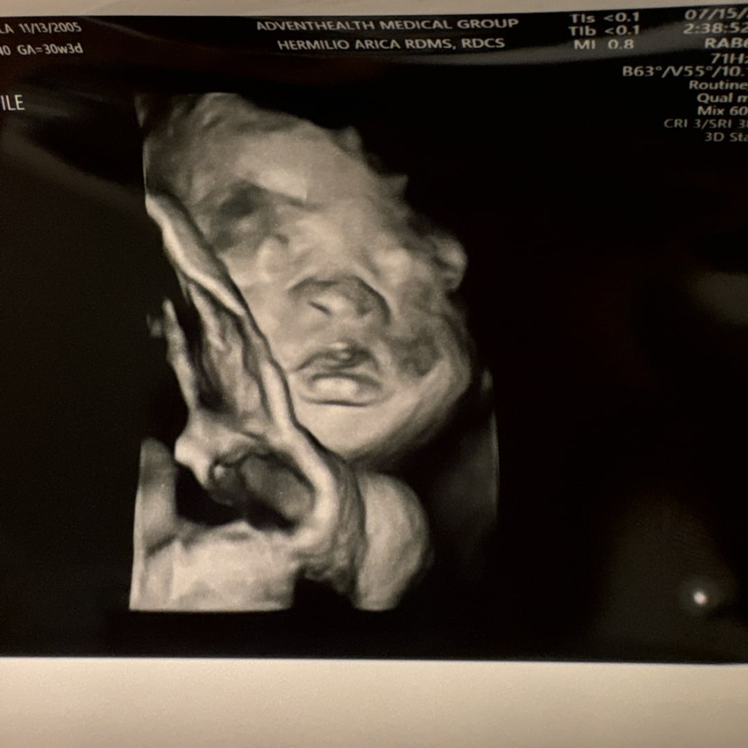 Photo shared by Jayla for their Babylist baby registry.