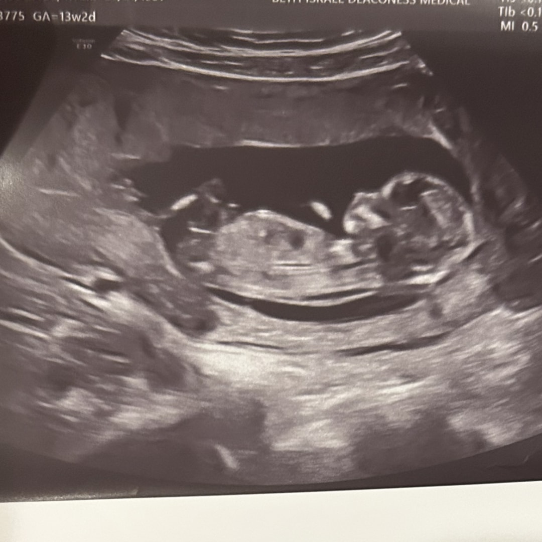 Photo shared by Kylie for their Babylist baby registry.