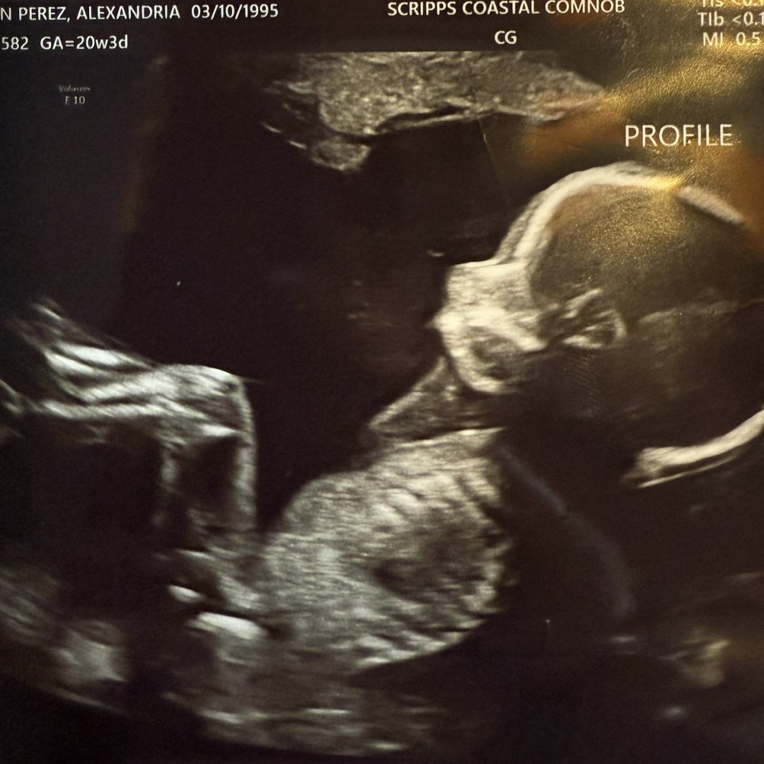 Photo shared by Alexandria for their Babylist baby registry.