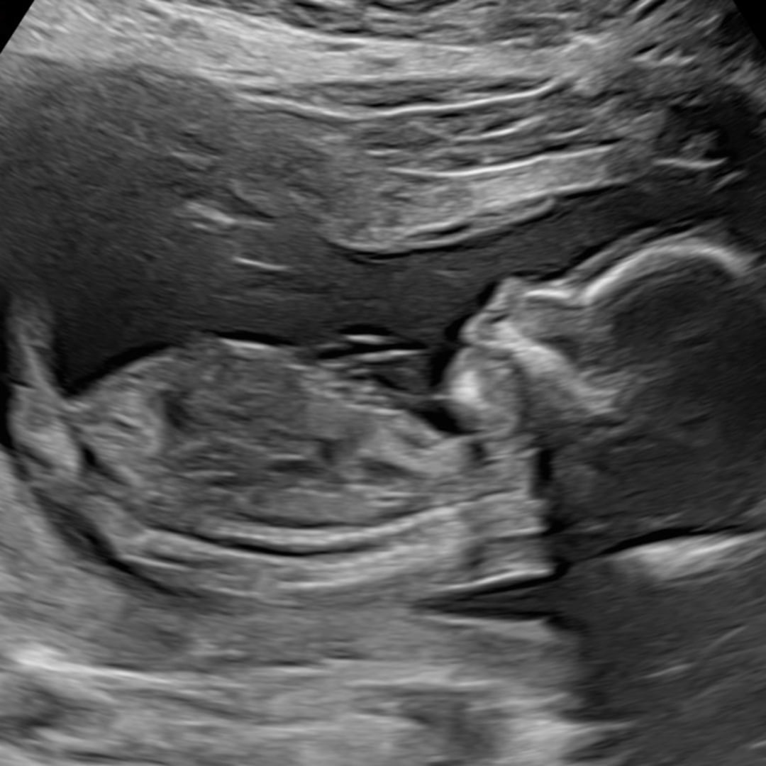 Photo shared by Ashley for their Babylist baby registry.