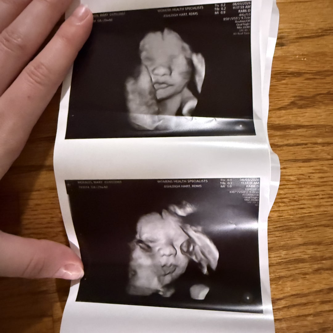 Photo shared by Isabella for their Babylist baby registry.