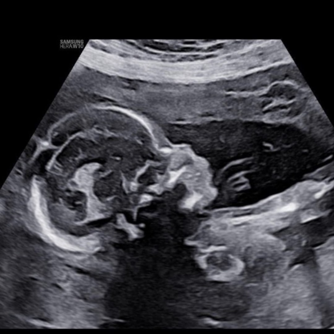 Photo shared by Shayna for their Babylist baby registry.