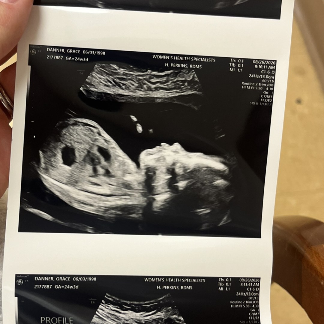 Photo shared by Grace for their Babylist baby registry.