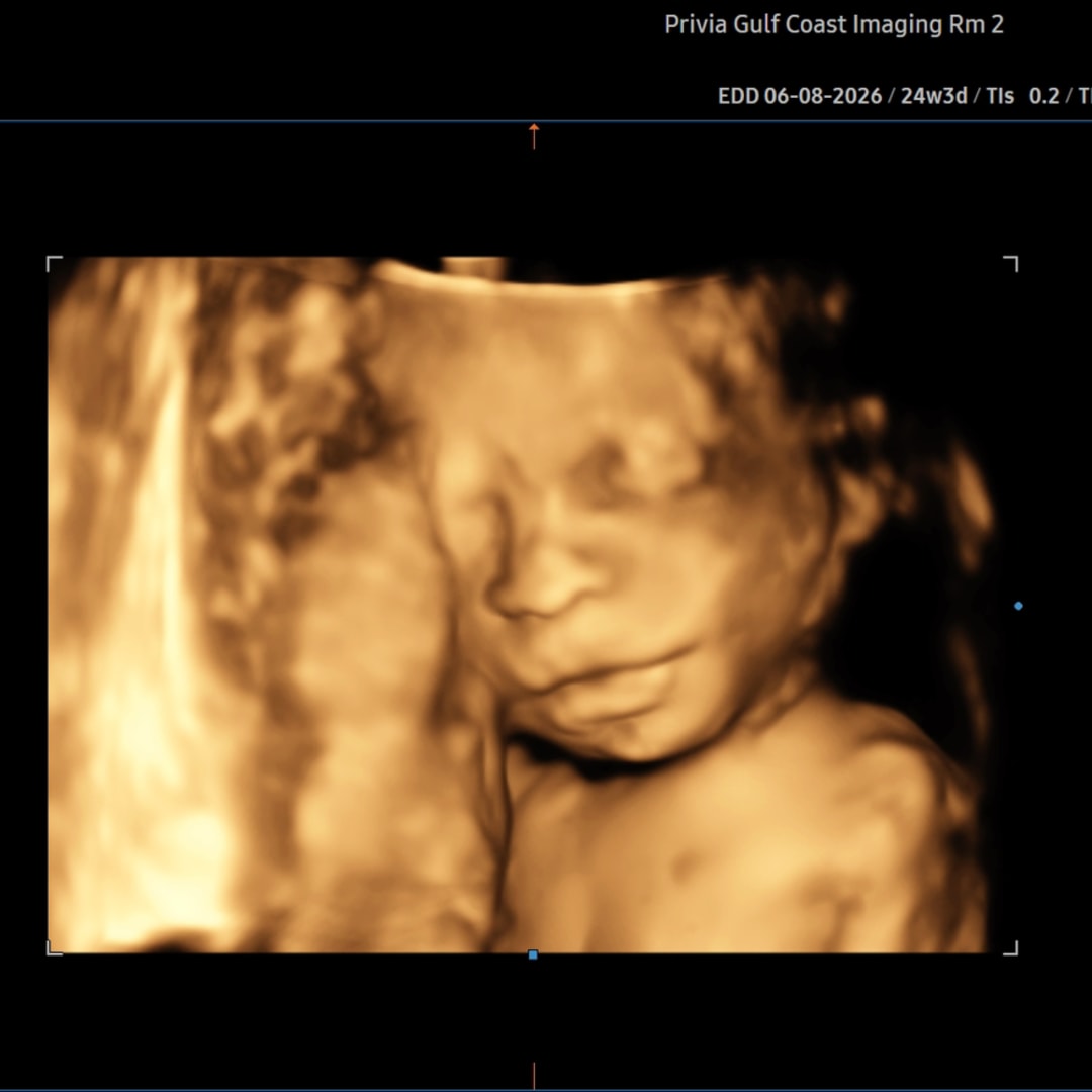 Photo shared by Lauren for their Babylist baby registry.