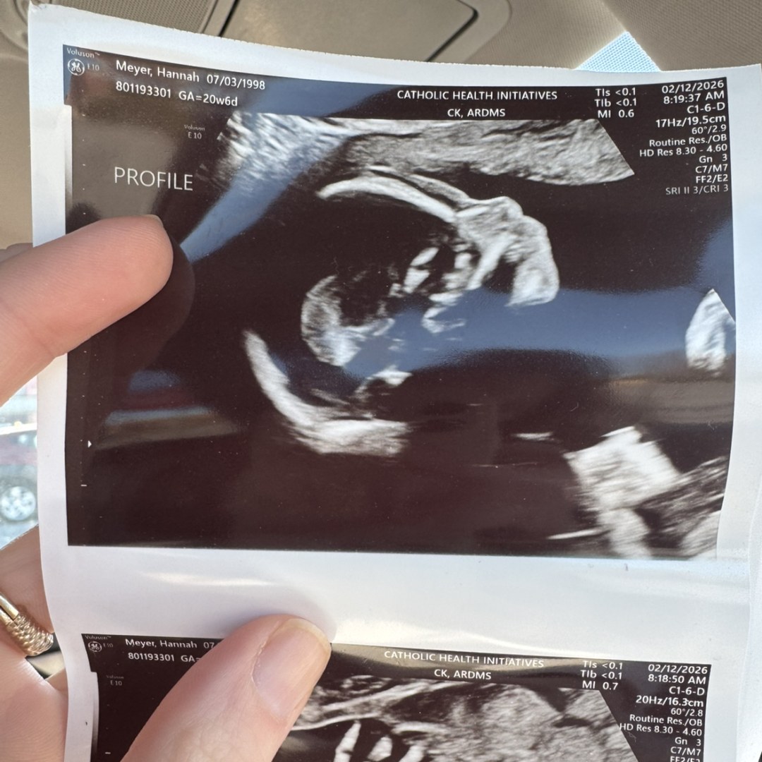 Photo shared by Hannah and Pierce for their Babylist baby registry.