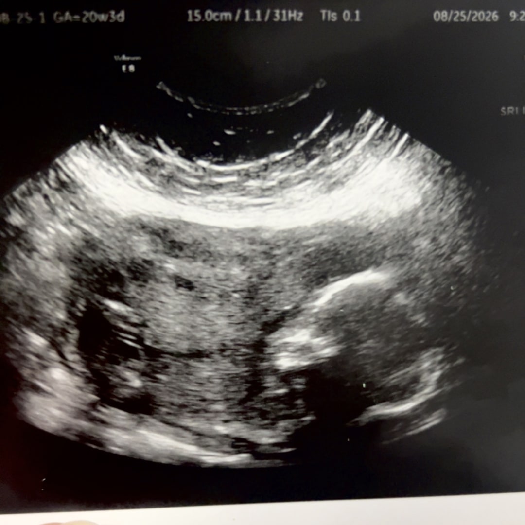 Photo shared by Phoenix for their Babylist baby registry.