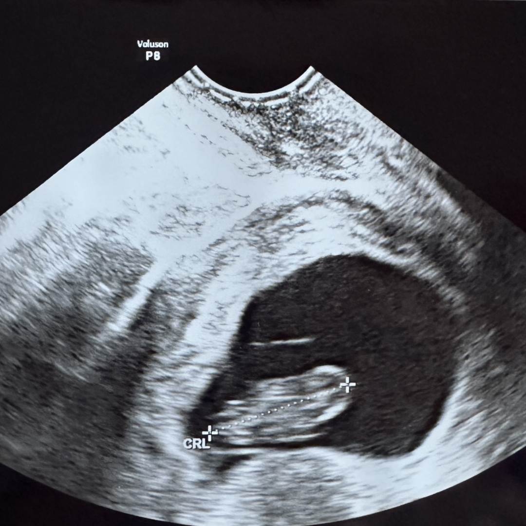 Photo shared by Katie for their Babylist baby registry.