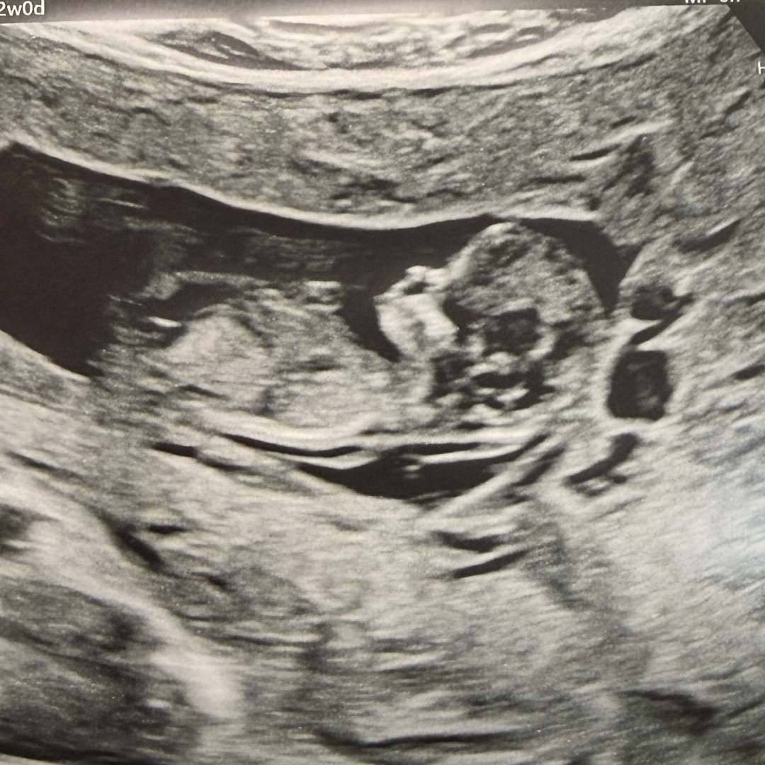 Photo shared by Dora for their Babylist baby registry.