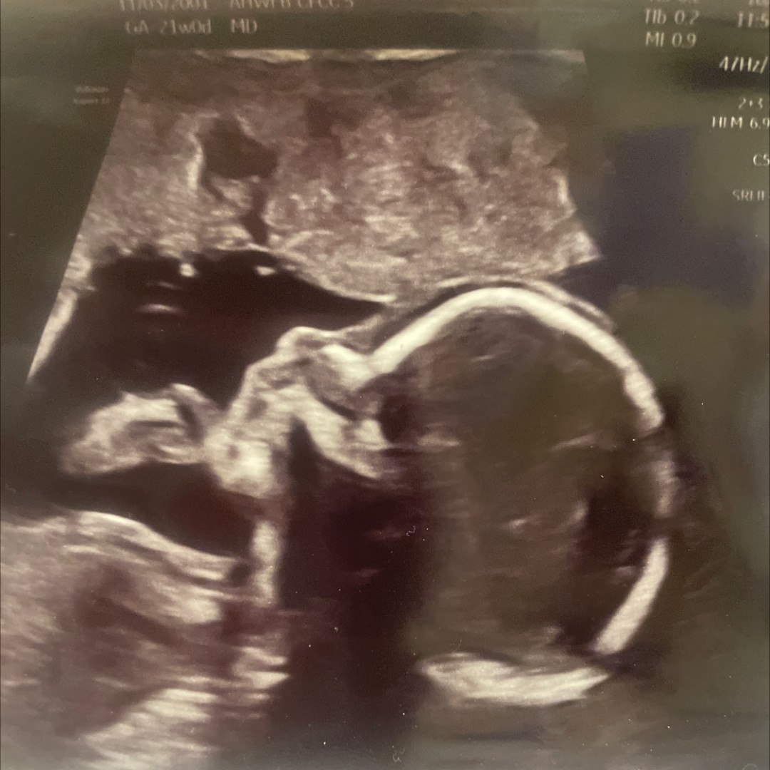 Photo shared by Shyann for their Babylist baby registry.