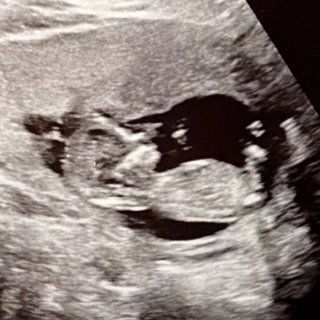 Photo shared by Sissy for their Babylist baby registry.