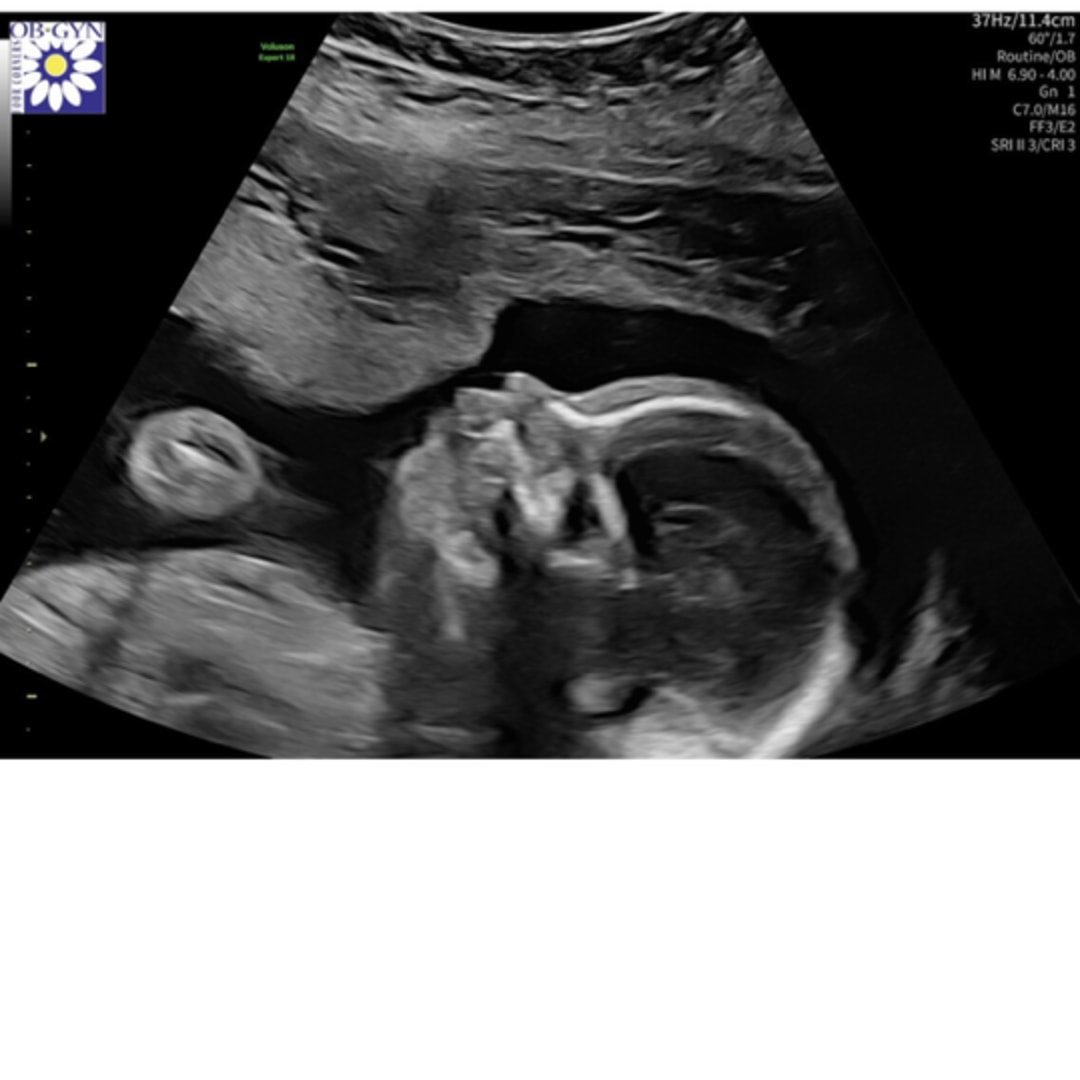 Photo shared by Virginia for their Babylist baby registry.