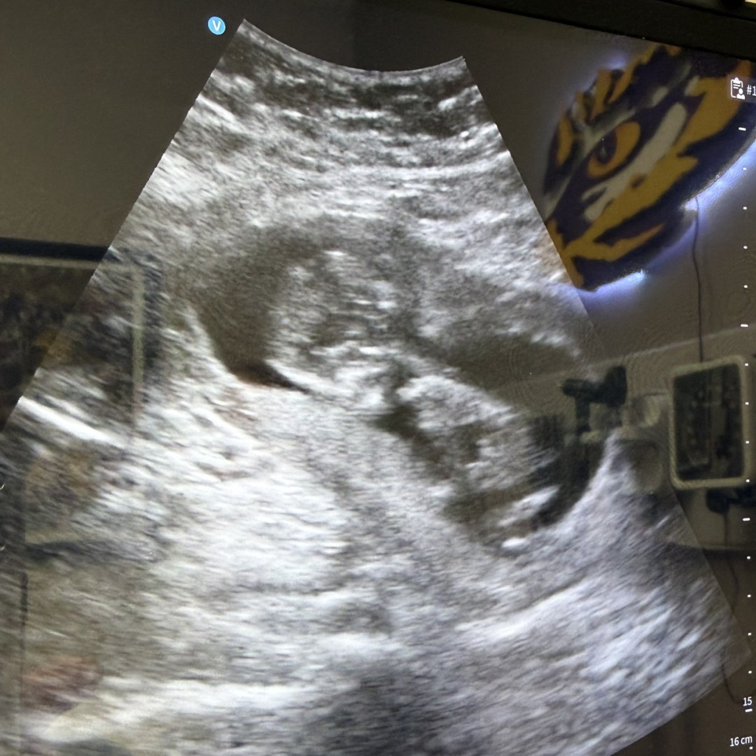Photo shared by Maggie for their Babylist baby registry.
