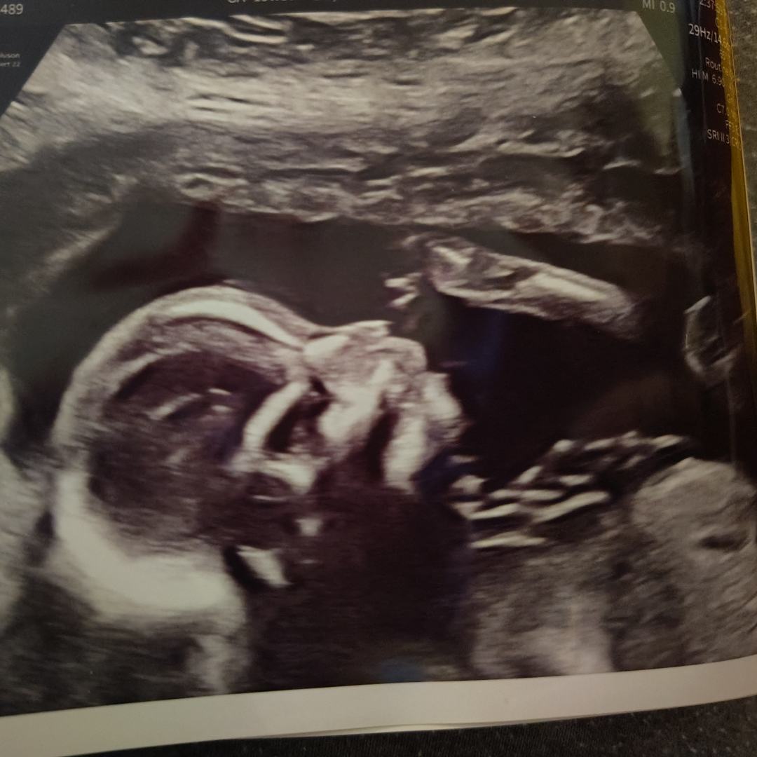 Photo shared by Abigail for their Babylist baby registry.