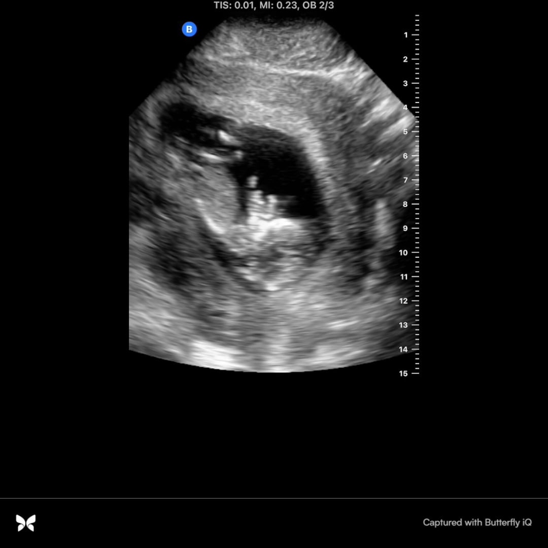 Photo shared by Kyra for their Babylist baby registry.