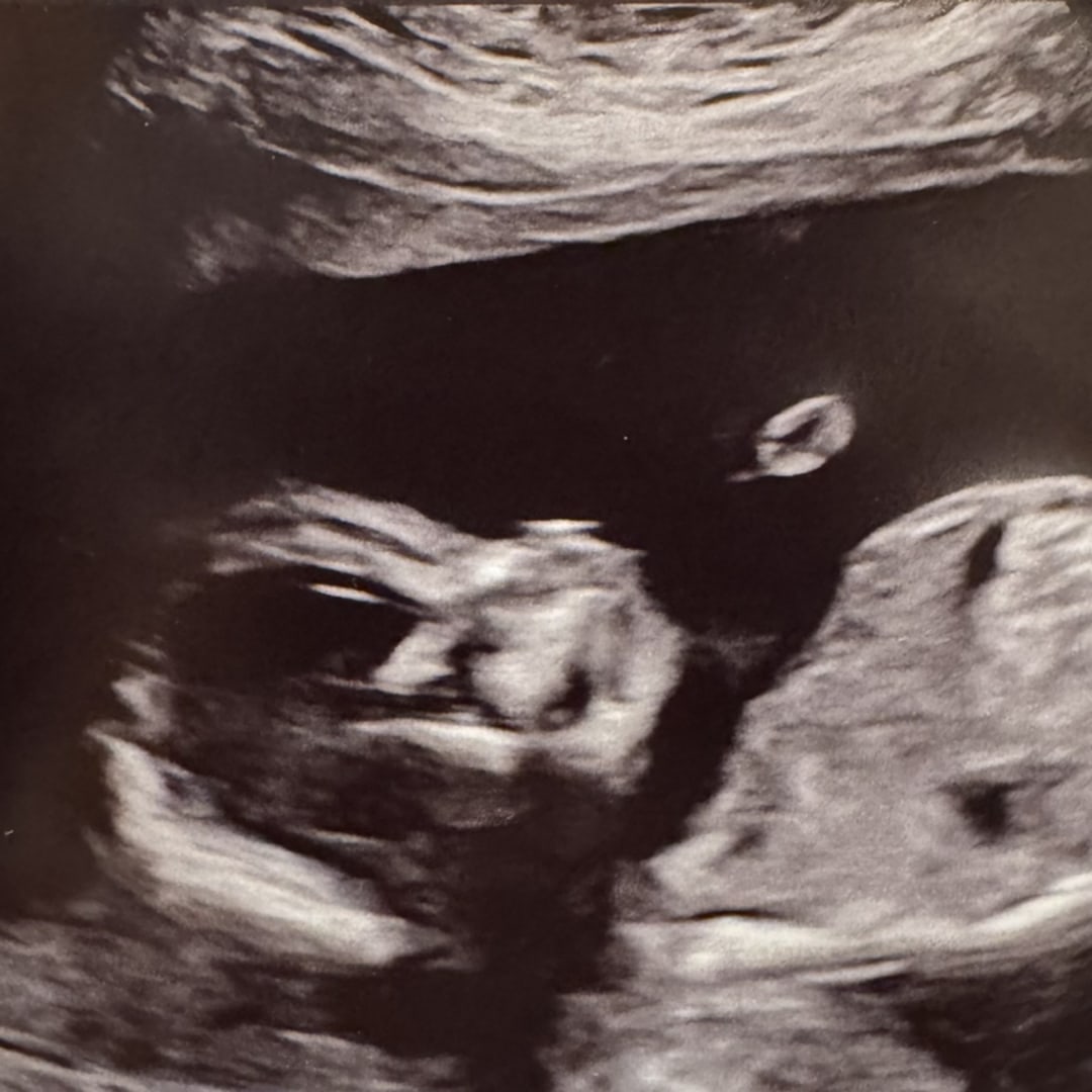 Photo shared by Lauren for their Babylist baby registry.