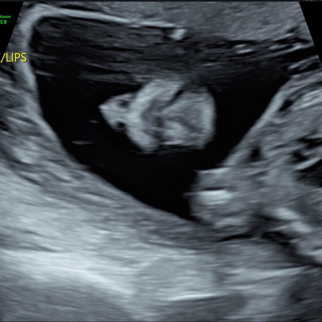 Photo shared by Abigail for their Babylist baby registry.