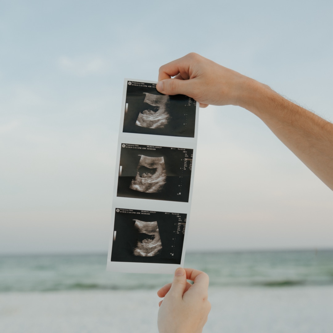 Photo shared by Ashley & Gabriel for their Babylist baby registry.