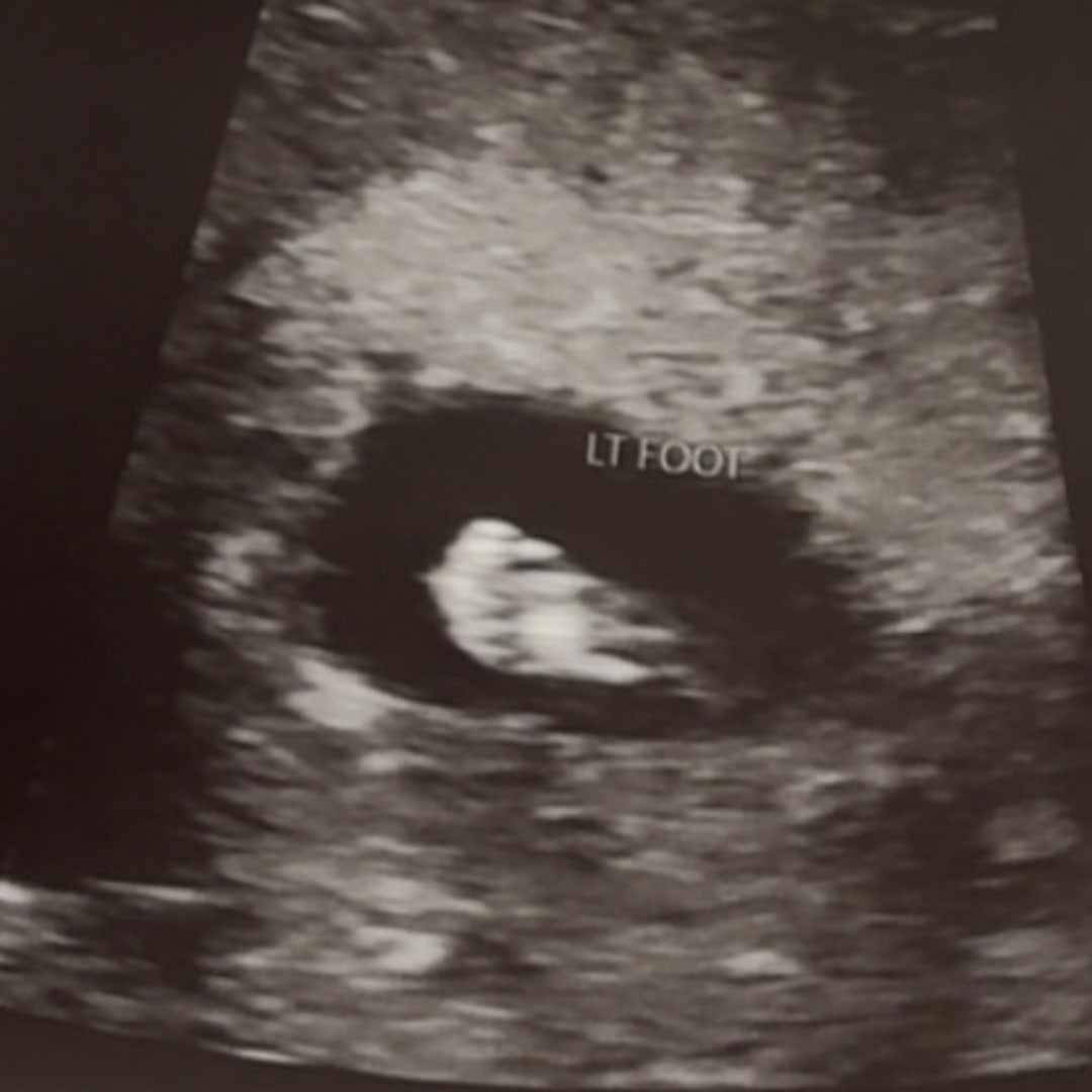 Photo shared by Callan for their Babylist baby registry.