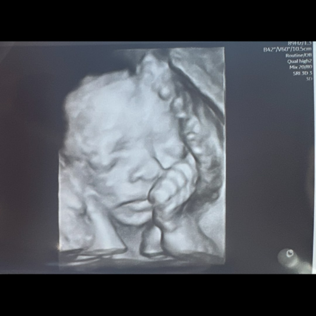 Photo shared by Paula for their Babylist baby registry.