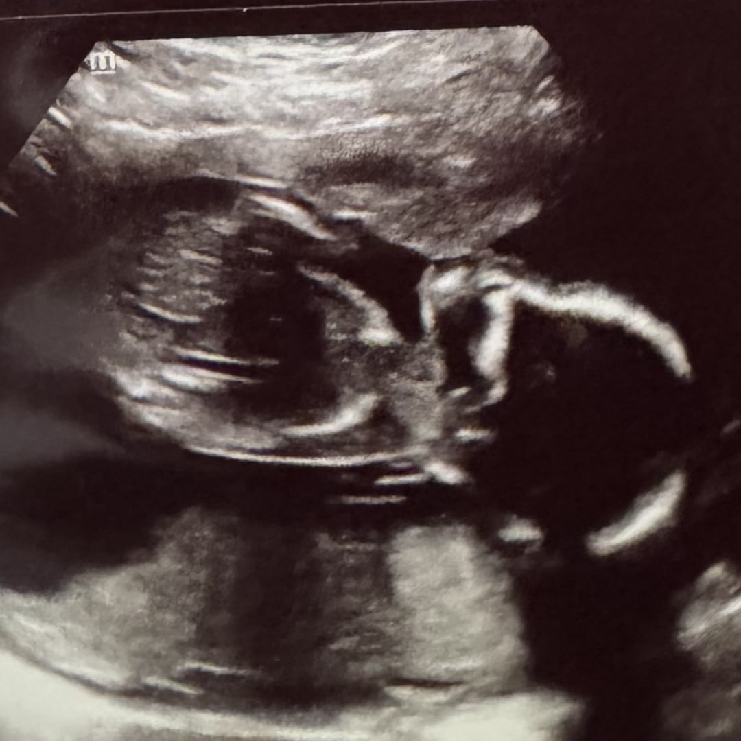 Photo shared by Alexis for their Babylist baby registry.