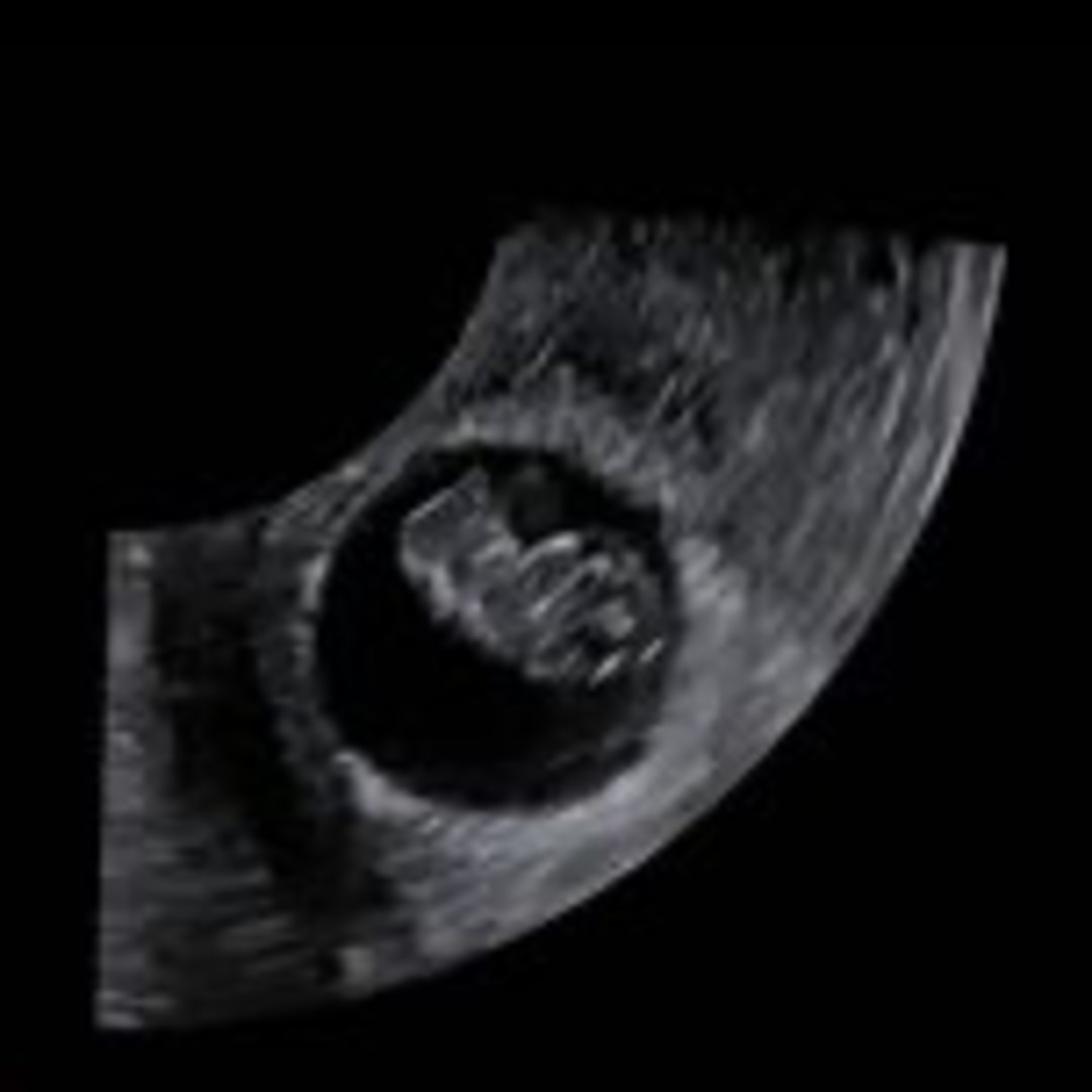 Photo shared by Maria for their Babylist baby registry.
