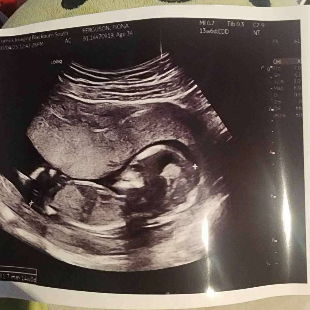Photo shared by Fee for their Babylist baby registry.