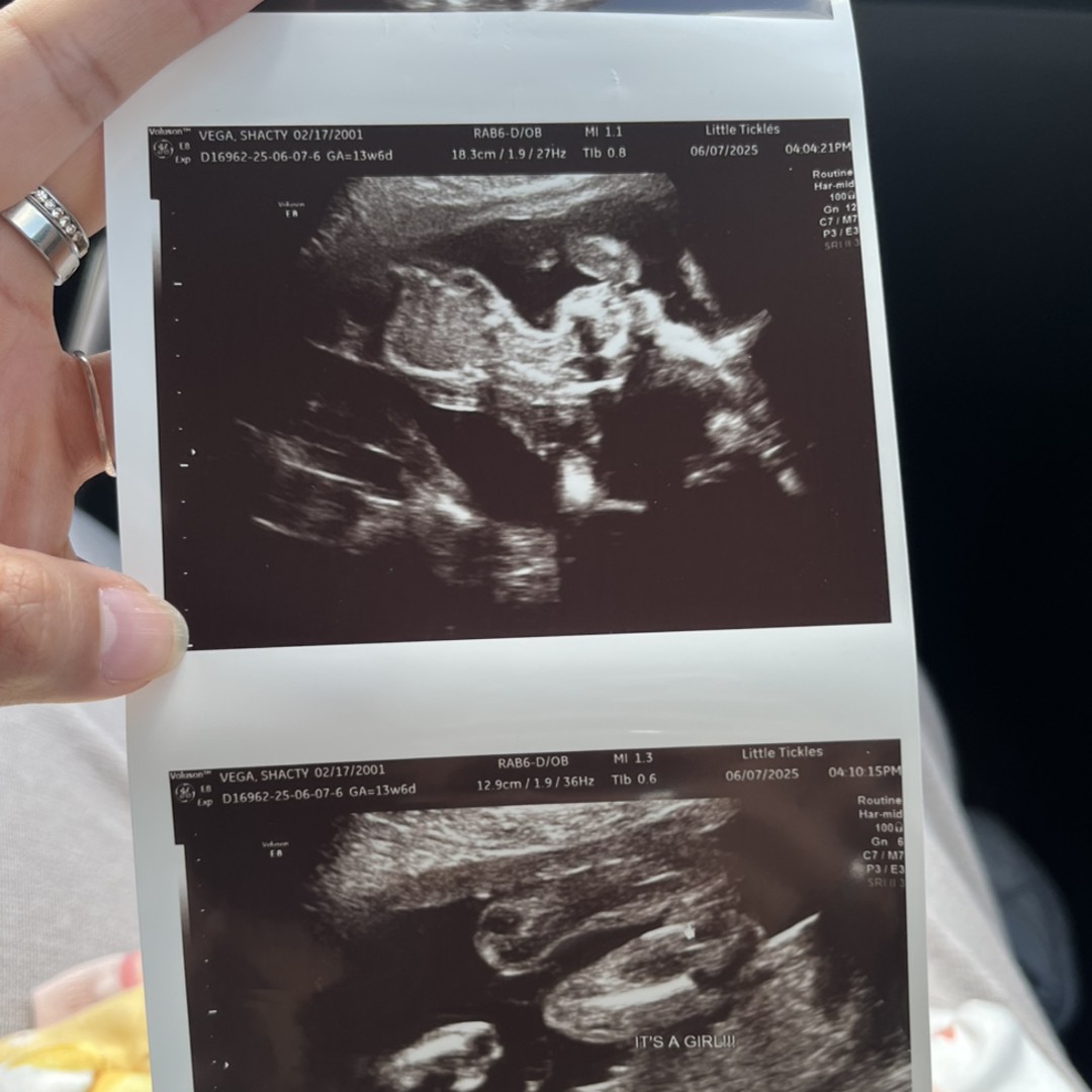 Photo shared by Shacty for their Babylist baby registry.